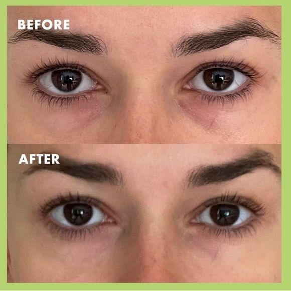 $6❤️‍🔥 KOPARI Niacinamide & Caffeine Eye Bright Cream 👁️ NEW - Picture 4 of 6